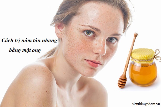 Cách trị nám mới xuất hiện bằng mật ong cach-tri-nam-va-tan-nhang-bang-mat-ong.jpg