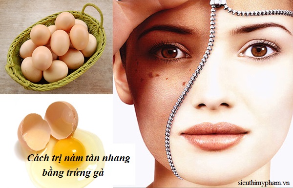Cách trị nám da dân gian bằng trứng gà cach-tri-nam-tan-nhang-bang-trung-ga.jpg